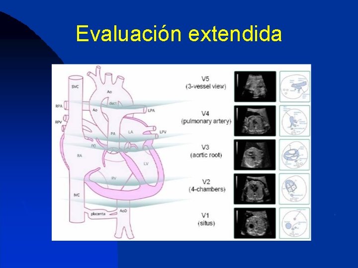 Evaluación extendida 