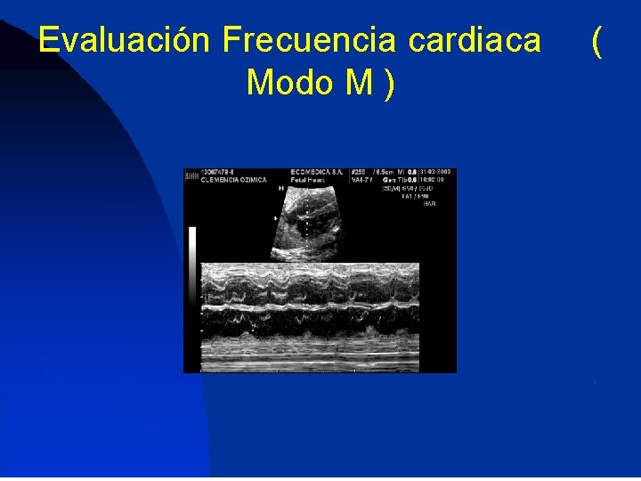 Evaluación Frecuencia cardiaca Modo M ) ( 