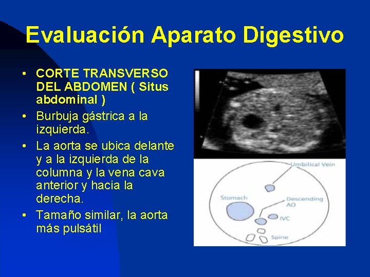 Evaluación Aparato Digestivo • CORTE TRANSVERSO DEL ABDOMEN ( Situs abdominal ) • Burbuja