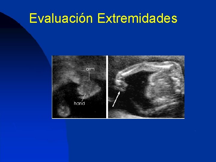 Evaluación Extremidades 