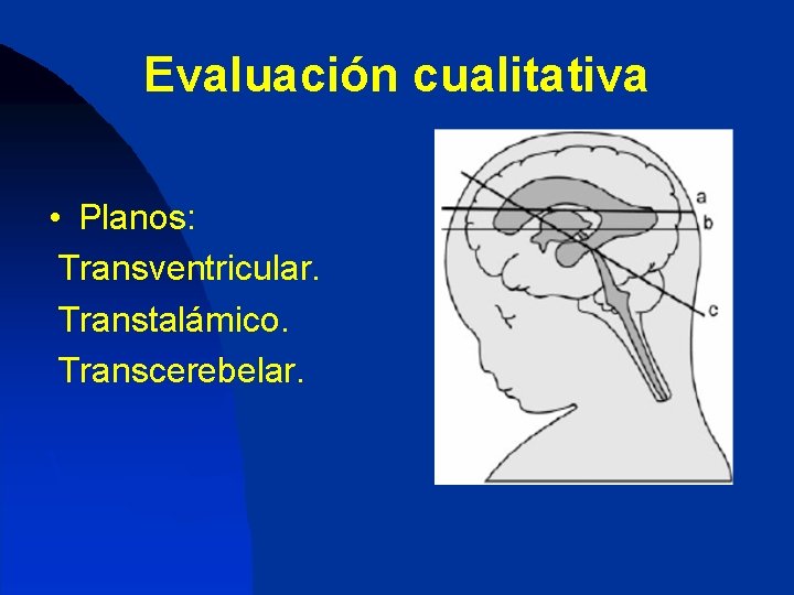 Evaluación cualitativa • Planos: Transventricular. Transtalámico. Transcerebelar. 