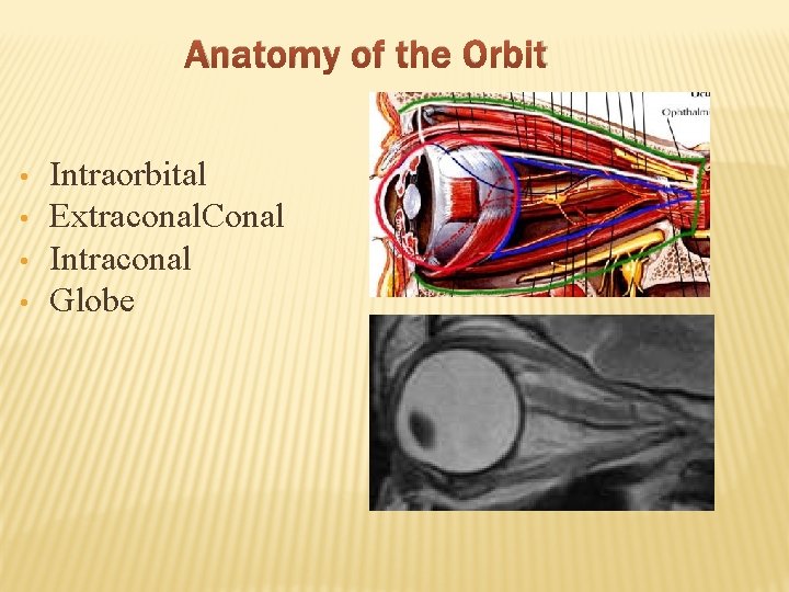 Anatomy of the Orbit • • Intraorbital Extraconal. Conal Intraconal Globe 