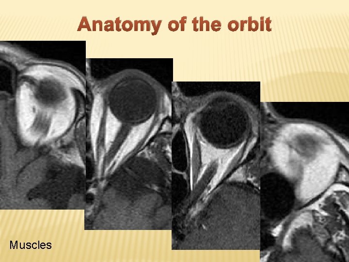 Anatomy of the orbit Muscles 