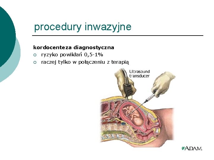 procedury inwazyjne kordocenteza diagnostyczna ¡ ryzyko powikłań 0, 5 -1% ¡ raczej tylko w