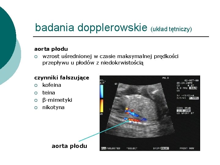 badania dopplerowskie (układ tętniczy) aorta płodu ¡ wzrost uśrednionej w czasie maksymalnej prędkości przepływu