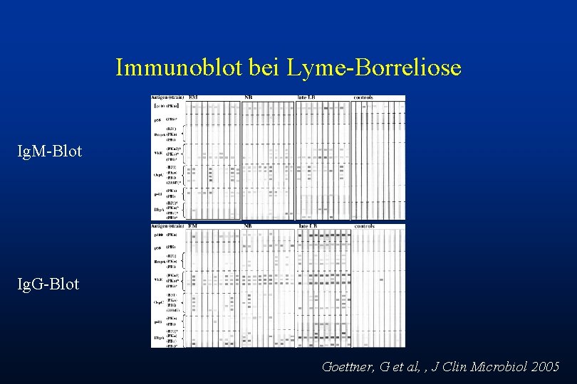 Immunoblot bei Lyme-Borreliose Ig. M-Blot Ig. G-Blot Goettner, G et al, , J Clin