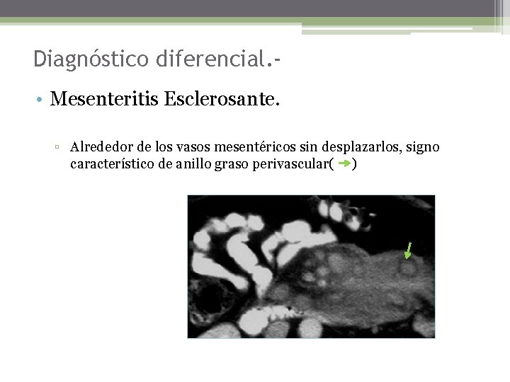 Diagnóstico diferencial. • Mesenteritis Esclerosante. ▫ Alrededor de los vasos mesentéricos sin desplazarlos, signo