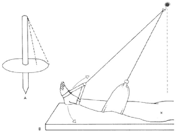 Suspension Therapy By Dr M Abbas Jamil Suspension