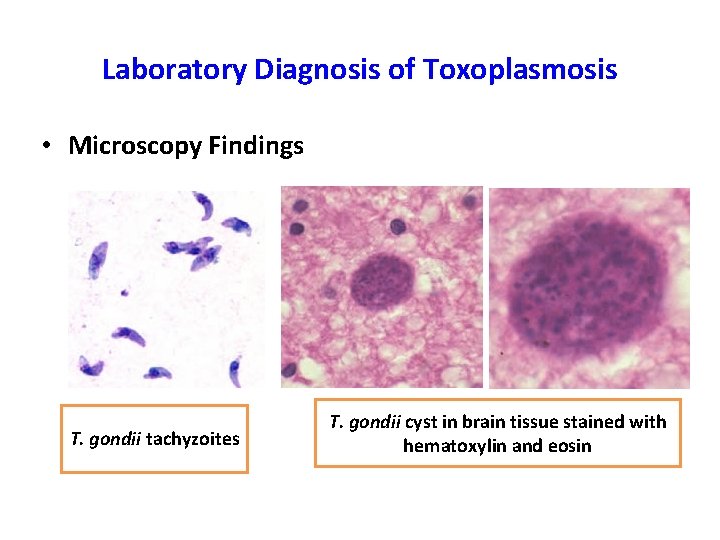 Laboratory Diagnosis of Toxoplasmosis • Microscopy Findings T. gondii tachyzoites T. gondii cyst in