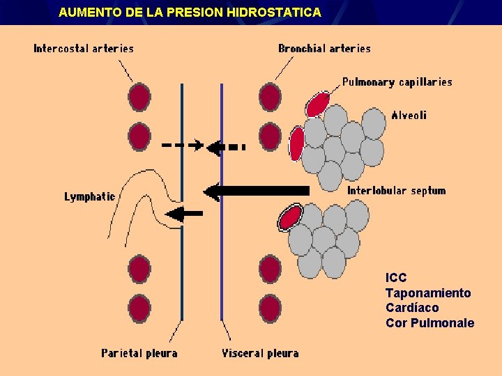AUMENTO DE LA PRESION HIDROSTATICA ICC Taponamiento Cardíaco Cor Pulmonale Derrame Pleural 24 