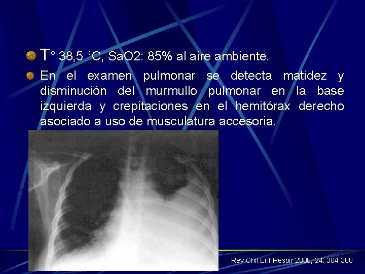 T° 38, 5 °C, Sa. O 2: 85% al aire ambiente. En el examen