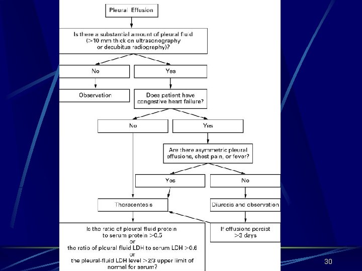 Derrame Pleural 30 