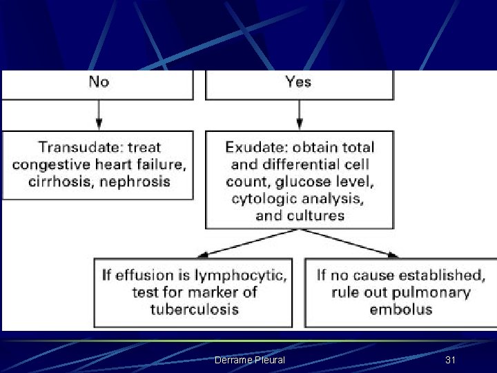 Derrame Pleural 31 