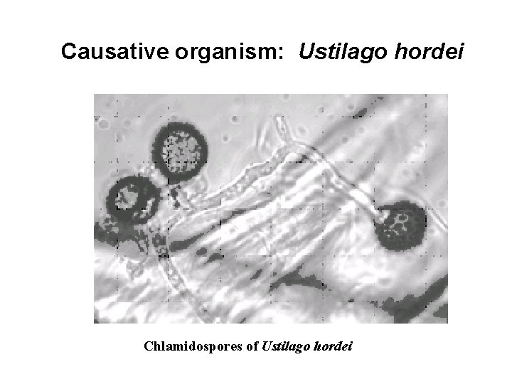 Causative organism: Ustilago hordei Chlamidospores of Ustilago hordei 