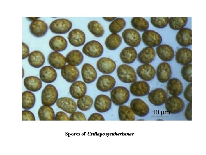 Spores of Ustilago syntherismae 