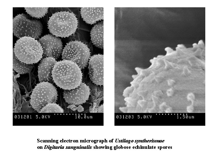Scanning electron micrograph of Ustilago syntherismae on Digitaria sanguinalis showing globose echinulate spores 
