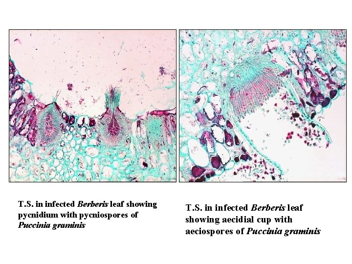 T. S. in infected Berberis leaf showing pycnidium with pycniospores of Puccinia graminis T.