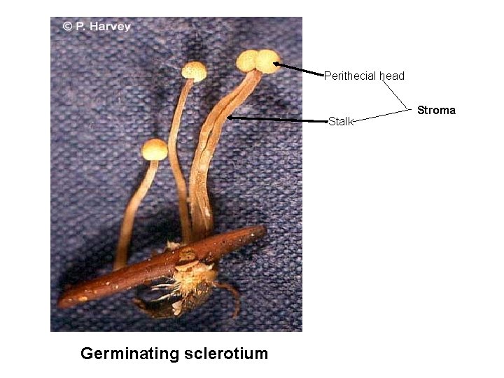 Perithecial head Stalk Germinating sclerotium Stroma 
