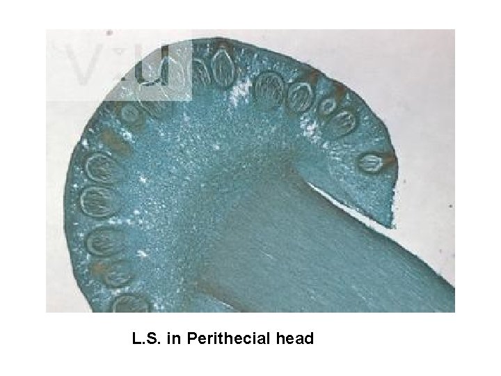 L. S. in Perithecial head 