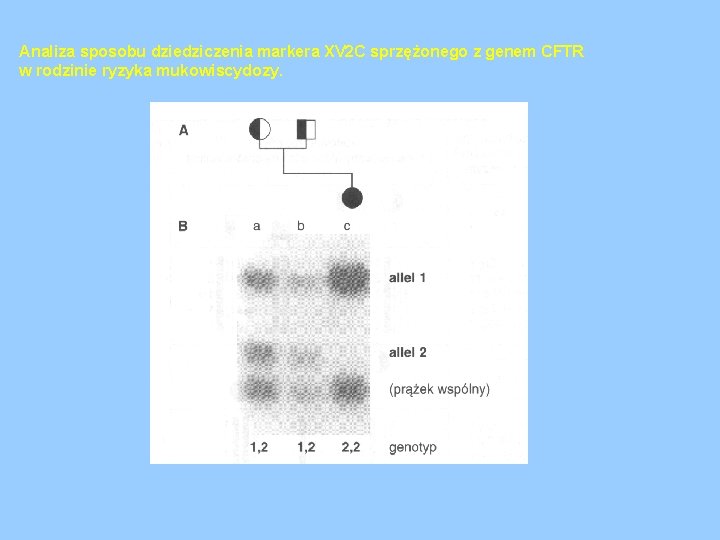 Analiza sposobu dziedziczenia markera XV 2 C sprzężonego z genem CFTR w rodzinie ryzyka