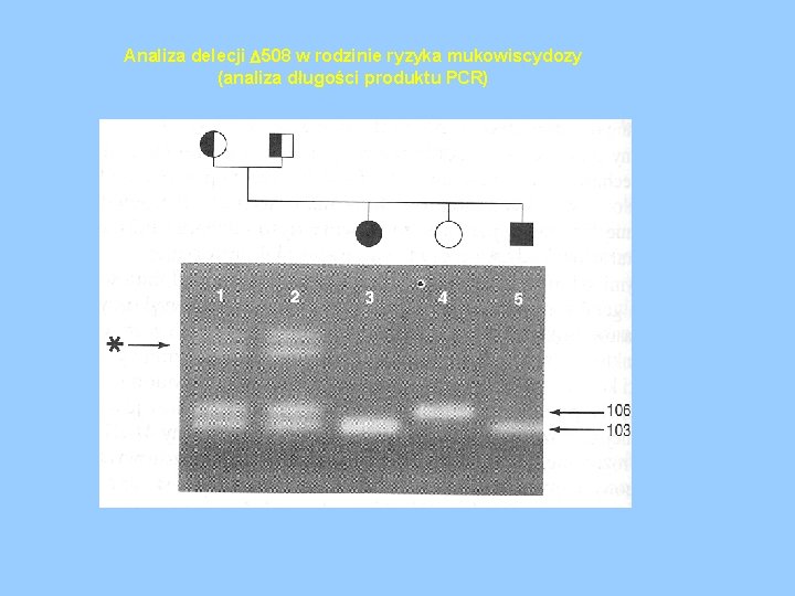 Analiza delecji 508 w rodzinie ryzyka mukowiscydozy (analiza długości produktu PCR) 