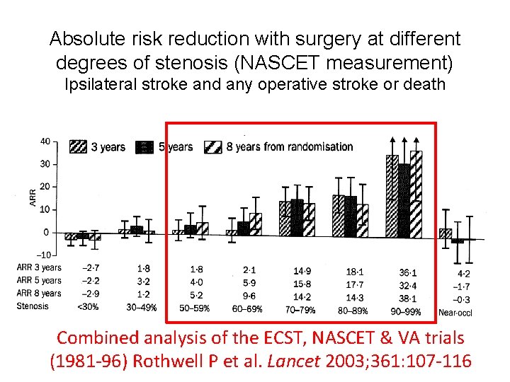 Absolute risk reduction with surgery at different degrees of stenosis (NASCET measurement) Ipsilateral stroke