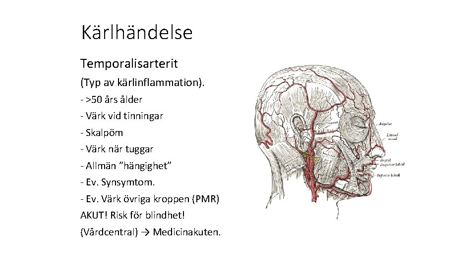 Kärlhändelse Temporalisarterit (Typ av kärlinflammation). - >50 års ålder - Värk vid tinningar -