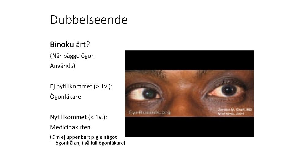 Dubbelseende Binokulärt? (När bägge ögon Används) Ej nytillkommet (> 1 v. ): Ögonläkare Nytillkommet
