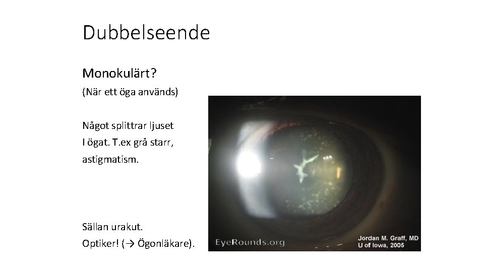 Dubbelseende Monokulärt? (När ett öga används) Något splittrar ljuset I ögat. T. ex grå