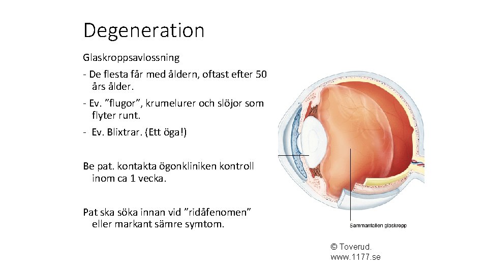 Degeneration Glaskroppsavlossning - De flesta får med åldern, oftast efter 50 års ålder. -
