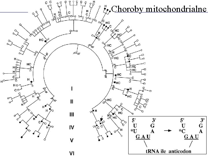Choroby mitochondrialne 