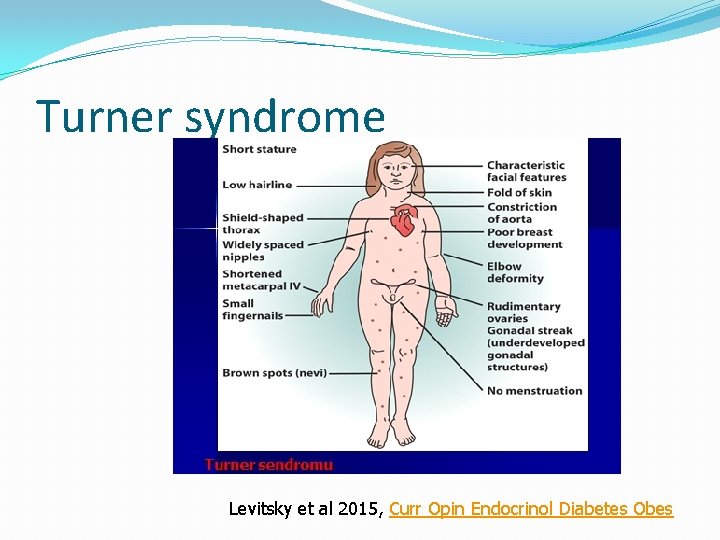 Turner syndrome Levitsky et al 2015, Curr Opin Endocrinol Diabetes Obes 