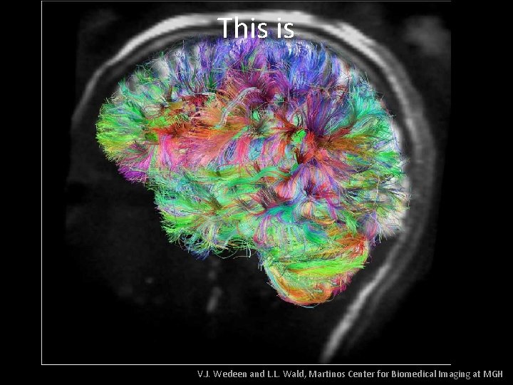 This is V. J. Wedeen and L. L. Wald, Martinos Center for Biomedical Imaging