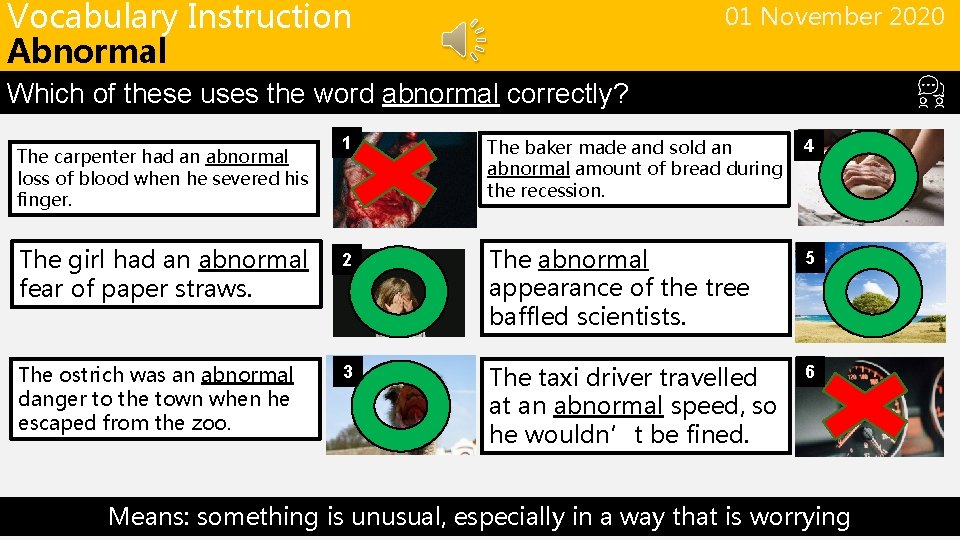 Vocabulary Instruction Abnormal 01 November 2020 Which of these uses the word abnormal correctly?