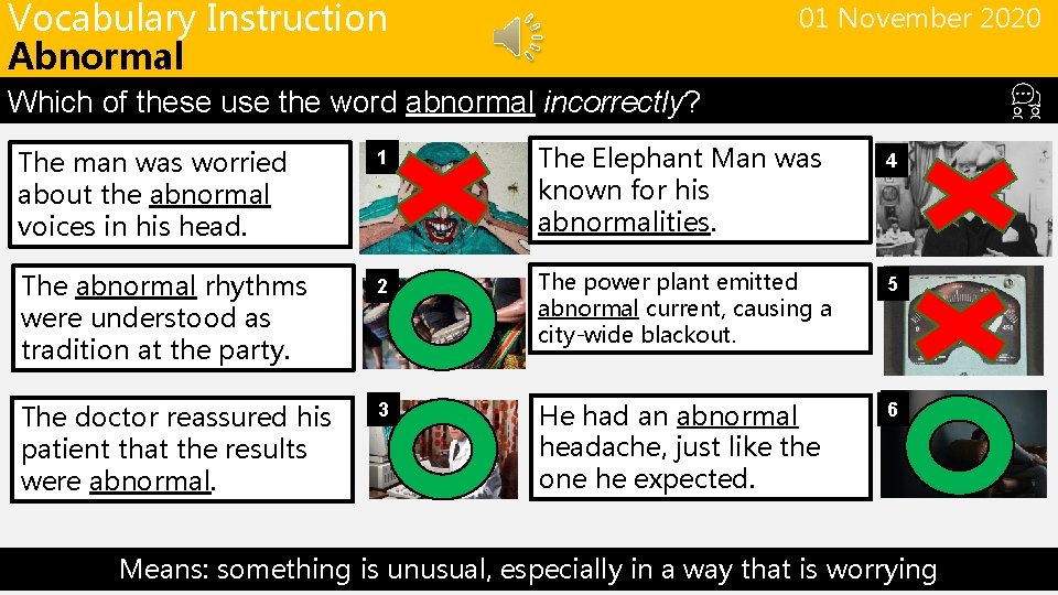 Vocabulary Instruction Abnormal 01 November 2020 Which of these use the word abnormal incorrectly?