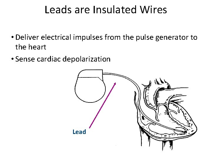 Leads are Insulated Wires • Deliver electrical impulses from the pulse generator to the