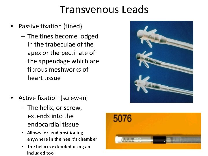 Transvenous Leads • Passive fixation (tined) – The tines become lodged in the trabeculae