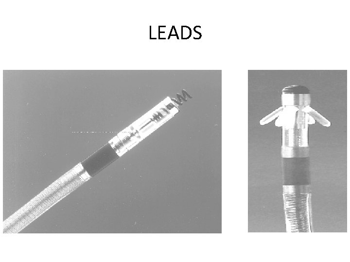 LEADS 