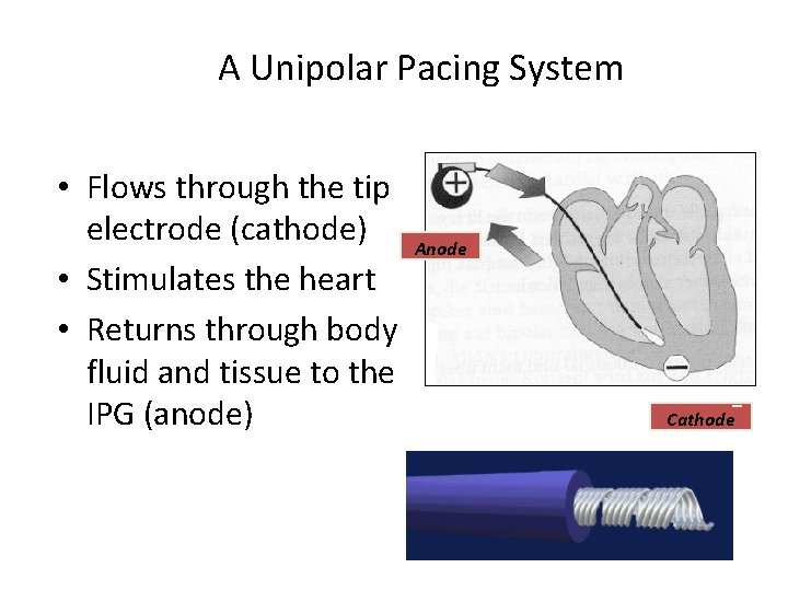 A Unipolar Pacing System • Flows through the tip electrode (cathode) Anode • Stimulates