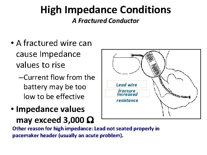 High Impedance Conditions A Fractured Conductor • A fractured wire can cause Impedance values