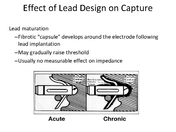 Effect of Lead Design on Capture Lead maturation – Fibrotic “capsule” develops around the