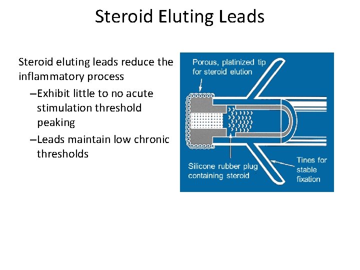 Steroid Eluting Leads Steroid eluting leads reduce the inflammatory process – Exhibit little to