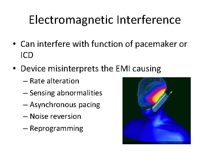 Electromagnetic Interference • Can interfere with function of pacemaker or ICD • Device misinterprets