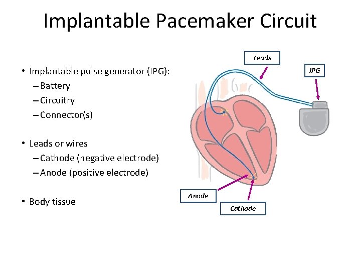 Implantable Pacemaker Circuit Leads • Implantable pulse generator (IPG): – Battery – Circuitry –