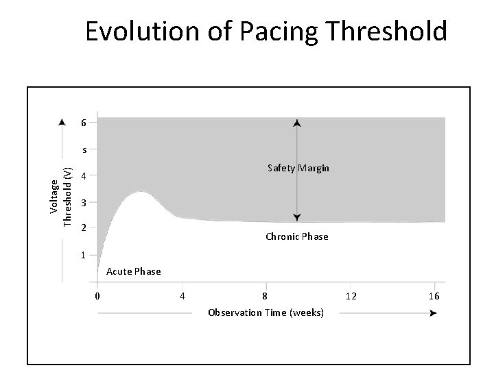 Evolution of Pacing Threshold 6 Voltage Threshold (V) s Safety Margin 4 3 2