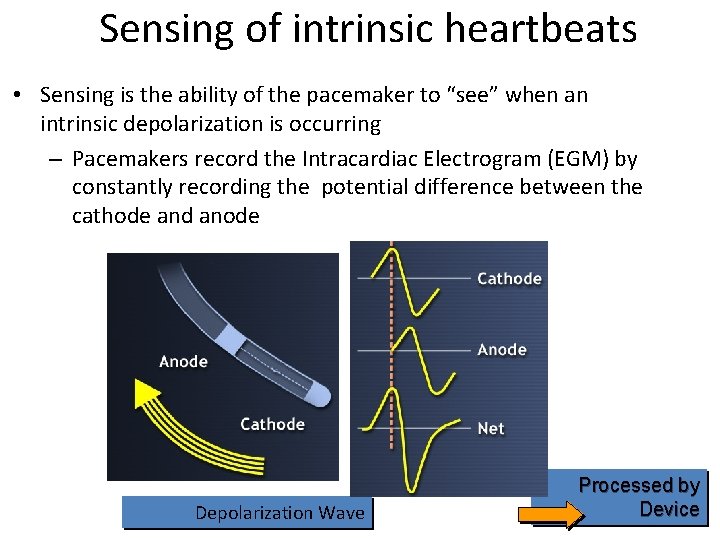 Sensing of intrinsic heartbeats • Sensing is the ability of the pacemaker to “see”