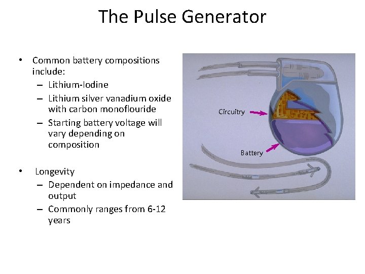 The Pulse Generator • Common battery compositions include: – Lithium-Iodine – Lithium silver vanadium