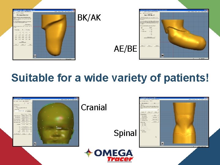 BK/AK AE/BE Suitable for a wide variety of patients! Cranial Spinal 