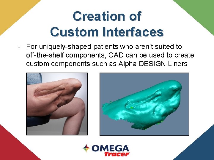 Creation of Custom Interfaces • For uniquely-shaped patients who aren’t suited to off-the-shelf components,