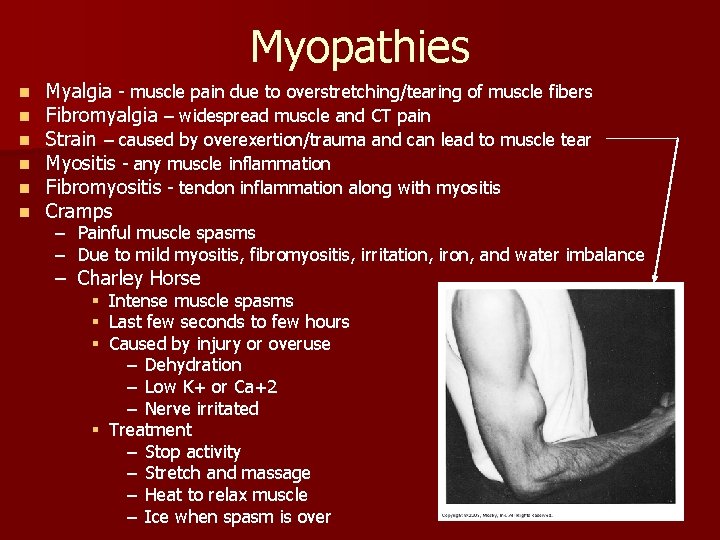 Myopathies n n n Myalgia - muscle pain due to overstretching/tearing of muscle fibers